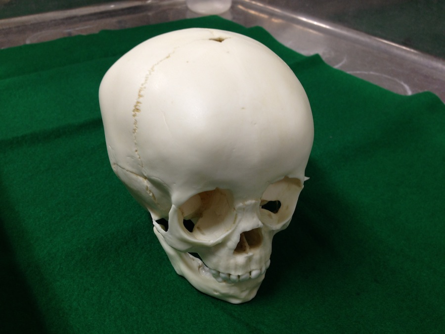 Replica of 1.5-year-old subadult skull